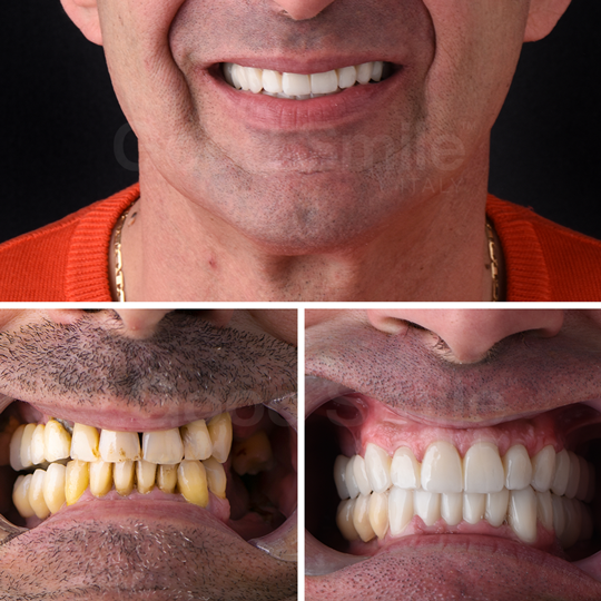 Enzo-Palumbo-PD-SITO-2