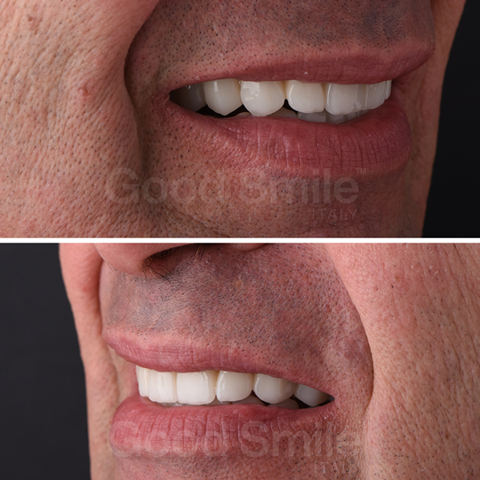 Enzo-Palumbo-PD-Sito