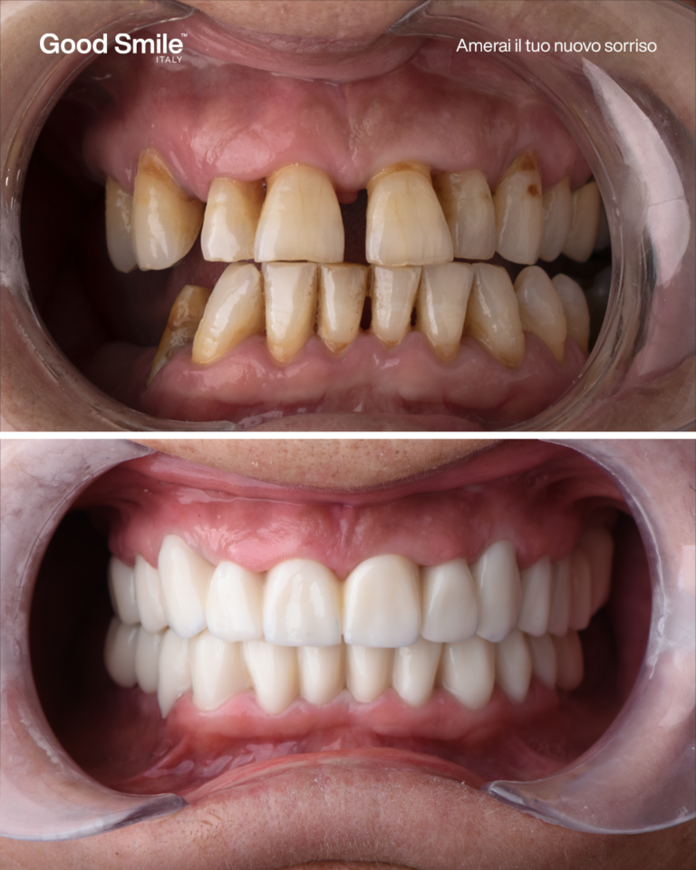 Layout Prima e dopo Def 1 - Abagnale Nunzia